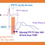 Pulse Wave Transit Time