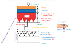 Chỉ số Perfusion Index