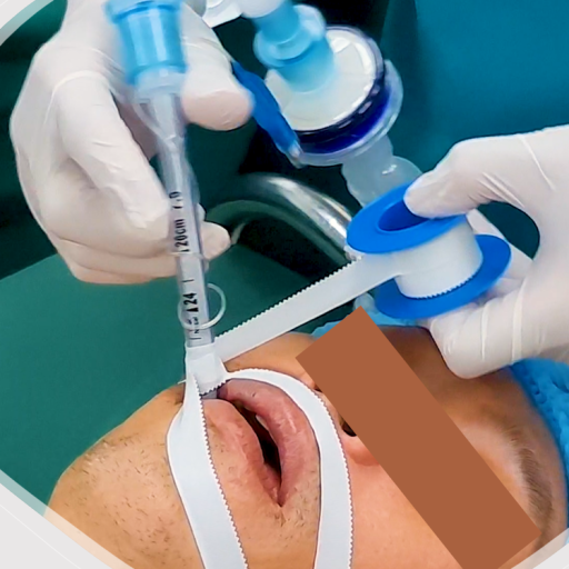 ĐẶT NKQ TRÊN NGƯỜI TRƯỞNG THÀNH