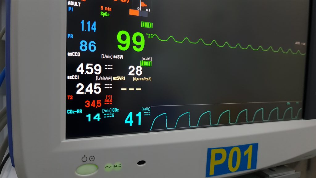 Estimated continuous cardiac output / esCCO.