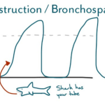 CO THẮT PHẾ QUẢN TRONG GÂY MÊ
