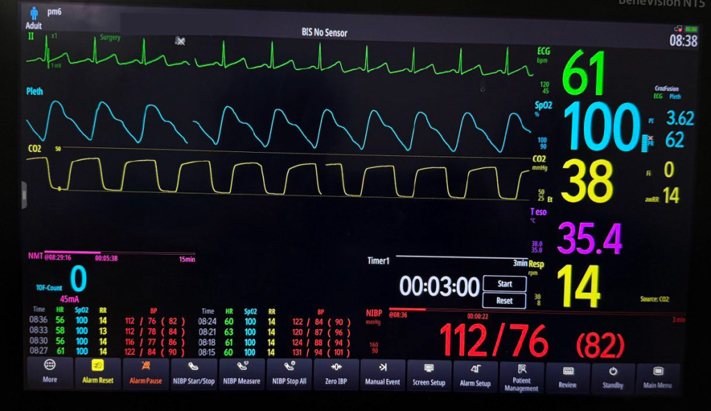 CHI SO SINH HIEU CO BAN THEO DOI TRONG GAY ME