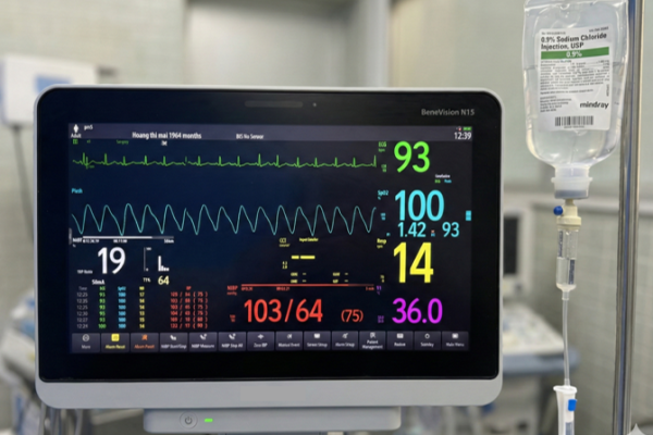 DUNG DICH NACL 0.9% TRONG GMHS