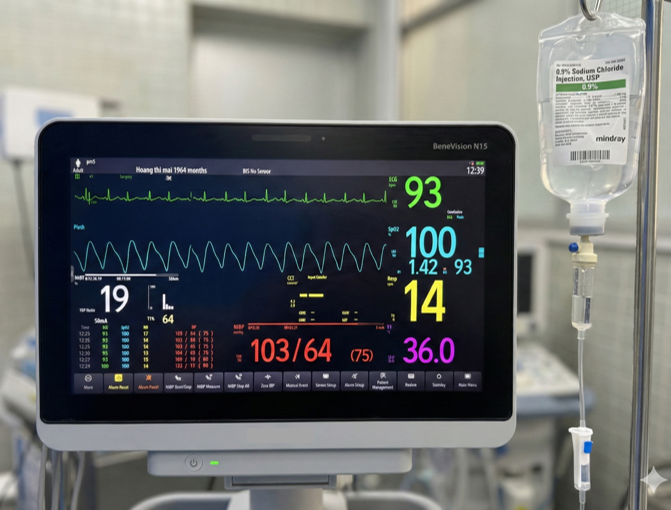 DUNG DICH NACL 0.9% TRONG GMHS