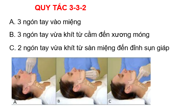 QUY TẮC 3 3 2 TIEN LƯỢNG ĐẶT NKQ KHÓ