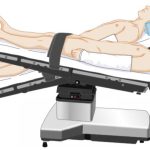 TƯ THẾ TRENDELENBURD