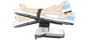 TƯ THẾ TRENDELENBURD