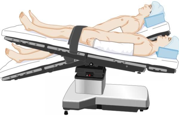 TƯ THẾ TRENDELENBURD