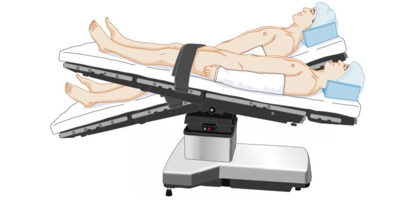 TƯ THẾ TRENDELENBURD