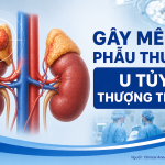 GÂY MÊ PHẪU THUẬT U TỦY THƯỢNG THẬN.