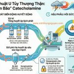 GAY ME U TUY THUONG THAN