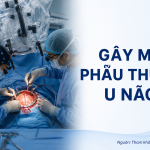 GÂY MÊ PHẪU THUẬT U NÃO