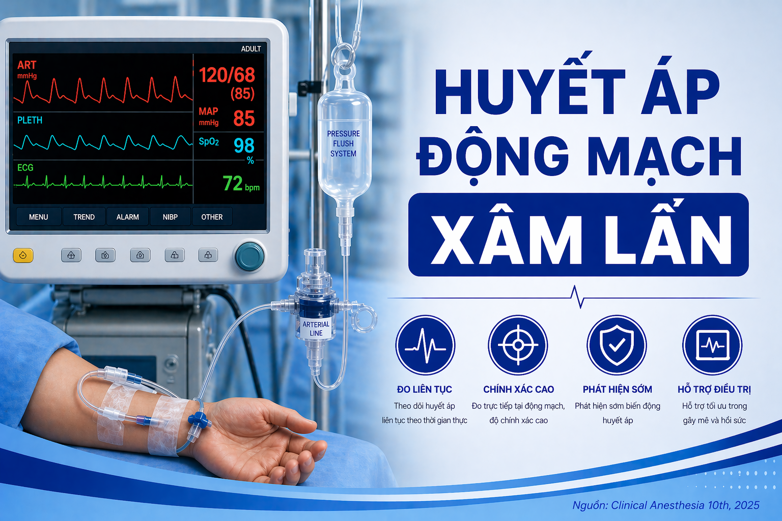 HUYẾT ÁP ĐỘNG MẠCH XÂM LẤN IBP