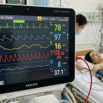 THEO DÕI HUYẾT ÁP ĐỘNG MẠCH XÂM LẤN