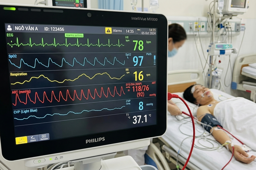 THEO DÕI HUYẾT ÁP ĐỘNG MẠCH XÂM LẤN