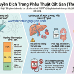 LIỆU PHÁP TRUYỀN DỊCH TRONG PT CẮT GAN