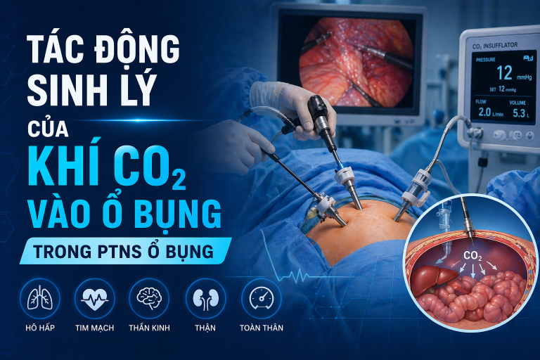 TÁC ĐỘNG SINH LÝ CỦA KHÍ CO2 KHI BƠM VÀO Ổ BỤNG