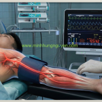 THEO DÕI HUYẾT ÁP KHÔNG XÂM LẤN TRONG GÂY MÊ