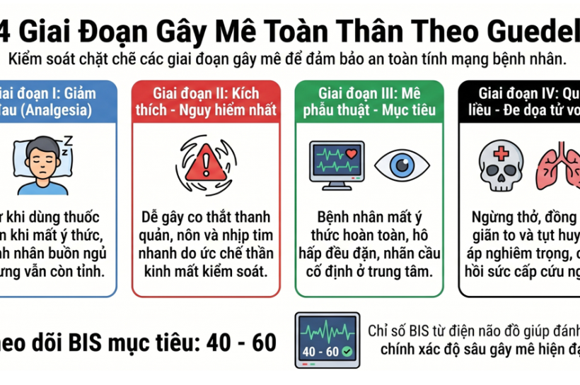 4 GIAI ĐOẠN CỦA GÂY MÊ