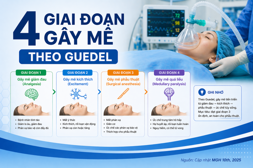 4 GIAI ĐOẠN GÂY MÊ THEO GUEDEL