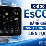 esCCO: Đánh Giá Cung Lượng Tim Liên Tục