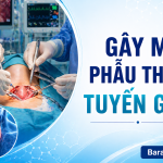 GÂY MÊ PT TUYẾN GIÁP