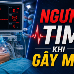 NGƯNG TIM KHI GÂY MÊ