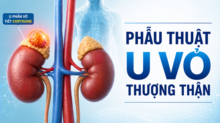 PT U VỎ THƯỢNG THẬN