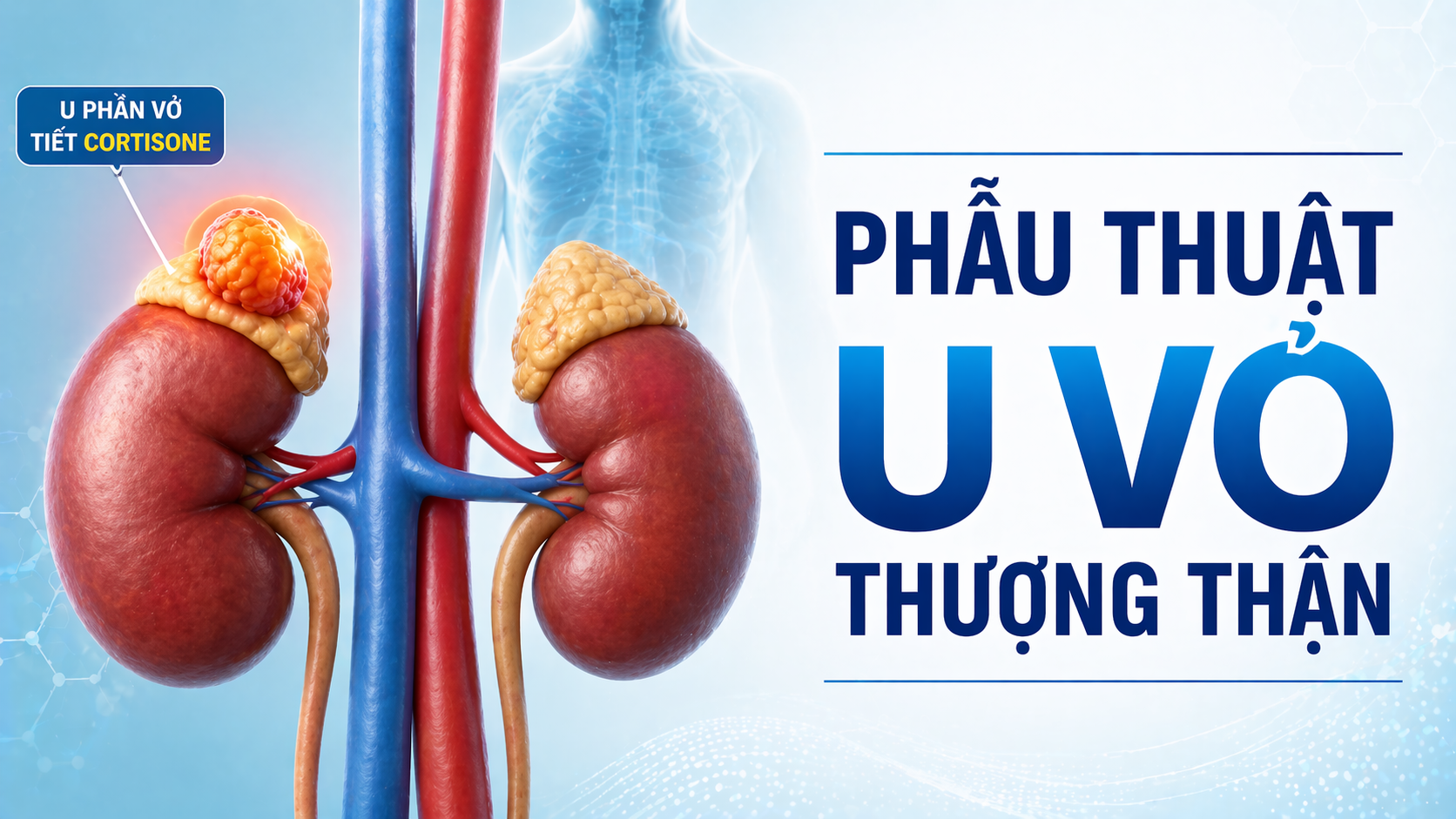 PT U VỎ THƯỢNG THẬN