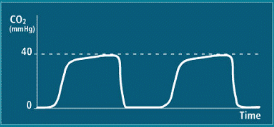 SÓNG ETCO2 BÌNH THƯỜNG