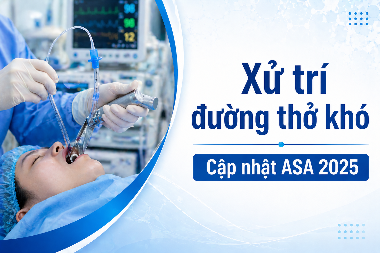 XỬ TRÍ ĐƯỜNG THỞ KHÓ